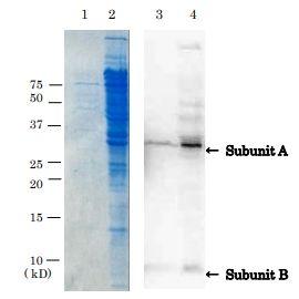 Anti-Verotoxin + Shiga Toxin Antibod