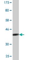 Anti-STAT6 Mouse Monoclonal Antibody [clone: 4G7]