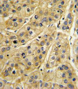 Anti-MHC Class 1 Chain-related Gene A Rabbit Polyclonal Antibody (PE (Phycoerythrin))