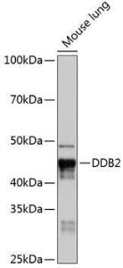 Western blot analysis of extracts of Mouse lung, using Anti-DDB2 Antibody [ARC0644] (A80839) at 1:1,000 dilution