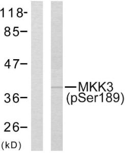 Western blot analysis of lysates from MDA-MB-435 cells using Anti-MKK3 (phospho Ser189) Antibody The left hand lane represents a negative control, where the antibody is blocked by the immunising peptide