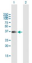 Anti-SFTPB Rabbit Polyclonal Antibody