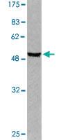 Anti-GFAP Rabbit Polyclonal Antibody