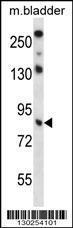 Anti-TRIM36 Rabbit Polyclonal Antibody (AP (Alkaline Phosphatase))