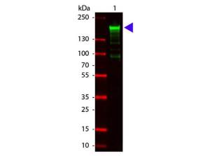 Anti-alpha-2-macroglobulin