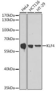 Western blot analysis of extracts of various cell lines, using Anti-KLF4 Antibody (A308429) at 1:1000 dilution. The secondary Antibody was Goat Anti-Rabbit IgG H&L Antibody (HRP) at 1:10000 dilution. Lysates/proteins were present at 25 µg per lane