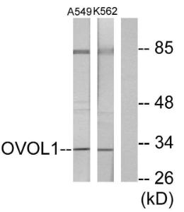 Western blot analysis of lysates from K562 and A549 cells using Anti-OVOL1 Antibody. The right hand lane represents a negative control, where the Antibody is blocked by the immunising peptide