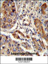 Anti-PTPRN Rabbit Polyclonal Antibody