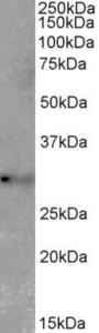 EB11779 (2 µg/ml) staining of Mouse Lung lysate (35 µg protein in RIPA buffer). Primary incubation was 1 hour. Detected by chemiluminescence.