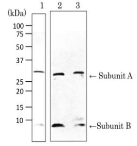 Anti-Verotoxin + Shiga Toxin Antibod