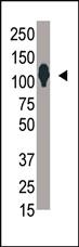 Anti-SENP6 Rabbit Polyclonal Antibody