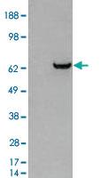 Anti-GRB7 Goat Polyclonal Antibody