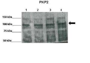 Anti-PKP2 Rabbit Polyclonal Antibody