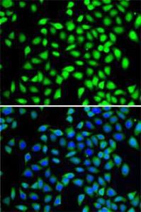 Immunofluorescence analysis of A-549 cells using Anti-SGTA Antibody (A7306). Blue: DAPI for nuclear staining