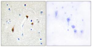 Immunohistochemical analysis of paraffin-embedded human brain tissue using Anti-HAIR Antibody. The right hand panel represents a negative control, where the Antibody was pre-incubated with the immunising peptide