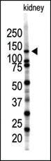 Anti-SENP7 Rabbit Polyclonal Antibody