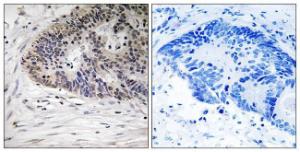 Antibody anti-MDM4 phospho SER367 100 µg