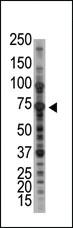 Anti-PIAS1 Rabbit Polyclonal Antibody