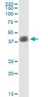 Anti-SFTPB Rabbit Polyclonal Antibody