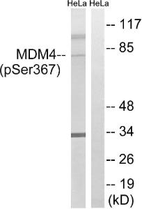 Antibody anti-MDM4 phospho SER367 100 µg