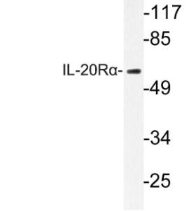 Antibody anti-IL-20R alpha 100 µg