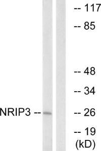 Anti-NRIP3 antibody