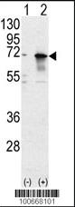 Anti-PIAS1 Rabbit Polyclonal Antibody