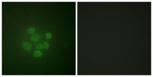 Anti-MDM2 Rabbit Polyclonal Antibody