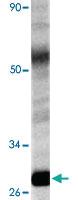 Anti-HSPB1 Rabbit Polyclonal Antibody