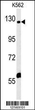 Anti-IQSEC3 Rabbit Polyclonal Antibody