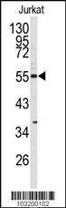 Anti-CDK8 Rabbit Polyclonal Antibody (PE (Phycoerythrin))