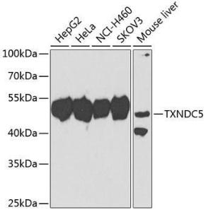 Antibody anti-TXNDC5 100 µl