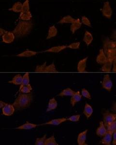 Immunofluorescence analysis of NIH/3T3 cells using Anti-GNA11 Antibody (A305802) at a dilution of 1:100. DAPI was used to stain the cell nuclei (blue)