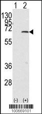 Anti-PIAS1 Rabbit Polyclonal Antibody