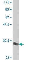 Anti-POU3F2 Mouse Polyclonal Antibody