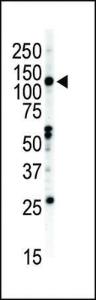 Anti-EPHB2 Rabbit Polyclonal Antibody (HRP (Horseradish Peroxidase))