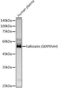 Western blot analysis of extracts of Human plasma, using Anti-Kallistatin / PI-4 Antibody (A10112) at 1:500 dilution. The secondary antibody was Goat Anti-Rabbit IgG H&L Antibody (HRP) at 1:10,000 dilution.