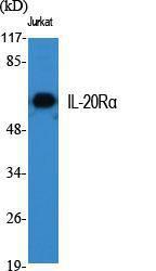 Antibody anti-IL-20R alpha 100 µg