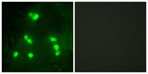 Immunofluorescence analysis of A549 cells using Anti-HAIR Antibody. The right hand panel represents a negative control, where the Antibody was pre-incubated with the immunising peptide