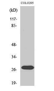 Anti-NRIP3 antibody