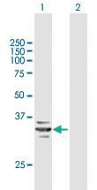 Anti-RARRES1 Mouse Polyclonal Antibody