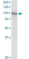 Anti-STAT6 Polyclonal Antibody Pair