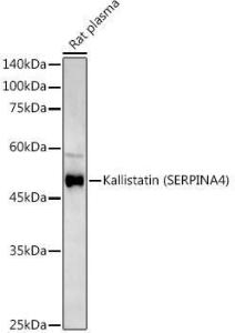 Western blot analysis of extracts of various cell lines, using Anti-Kallistatin / PI-4 Antibody (A10112) at 1:500 dilution. The secondary antibody was Goat Anti-Rabbit IgG H&L Antibody (HRP) at 1:10,000 dilution.