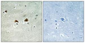 Immunohistochemical analysis of paraffin-embedded human brain using Anti-MAP4 (phospho Ser696) Antibody 1:100 (4°C overnight) The right hand panel represents a negative control, where the antibody was pre-incubated with the immunising peptide