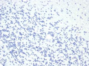 Negative Tissue Control: Immunohistochemical analysis of formalin-fixed, paraffin-embedded human brain using Anti-Growth Hormone Antibody [GH/4886R] at 2µg/ml in PBS for 30 minutes at room temperature