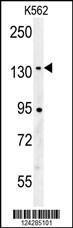 Anti-CILP2 Rabbit Polyclonal Antibody (AP (Alkaline Phosphatase))