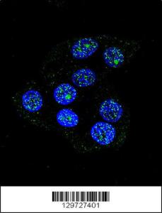 Anti-CCDC36 Rabbit Polyclonal Antibody (FITC (Fluorescein Isothiocyanate))