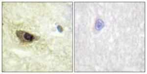 Immunohistochemical analysis of paraffin-embedded human brain using Anti-MAP4 (phospho Ser696) Antibody 1:100 (4°C overnight) The right hand panel represents a negative control, where the antibody was pre-incubated with the immunising peptide