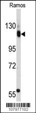 Anti-RB1 Rabbit Polyclonal Antibody