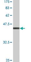 Anti-RARA Mouse Monoclonal Antibody [clone: 2C3]